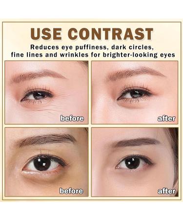 Effective Eye Cream for Dark Circles & Puffiness | Under Eye Serum & Roller - Daily Skincare for Women | Crema Para Las Ojeras - Buy Online on GoSupps.com