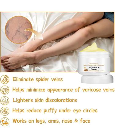 EXQST Fivfivgo Varicose Veins Miracle Cream Varicose Veins Treatment Cream Improves Circulation - Buy Online on GoSupps.com