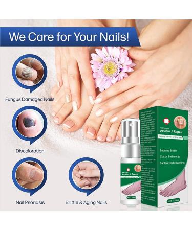 Nail Fungal Treatment Spray - Advanced Toenail & Nail Strengthener Repair - 10ml - Buy Online on GoSupps.com