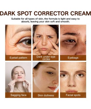 IZBEAUVO Dark Spot Remover for Face Dark Spot Cream Freckle Removal Cream Dark Spot Correcting Glow Serum Dark Spot Corrector Cream Dark Spot Remover Sunspots & Melasma Cream Anti-Aging - Buy Online on GoSupps.com