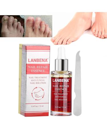 Nail Repair Essence 12ML - Powerful Anti-Fungus Treatment for Healthy Nails - Buy Online on GoSupps.com