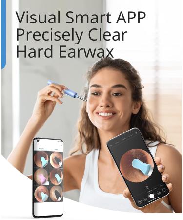 Ear Wax Removal Tool with 1080P Camera, Light, 2 Silicone Ear Spoons - Blue - Buy Online on GoSupps.com