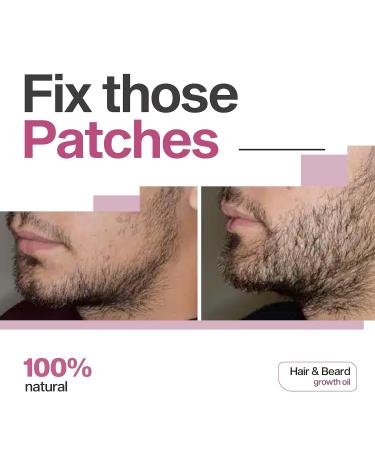 REVIPP Hair & Beard Oil with Rose Petals | 100% Natural Formula for Itching Dandruff & Grey Hair | Optimal Growth & Nourishing Peppermint Scent | 1 oz - Buy Online on GoSupps.com