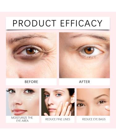 Retinol Eye Cream Anti Aging Instant Firm Eyes Anti Wrinkles Instant Dark Circles Under Eye Cream for Puffiness and Bags Under Eyes Firming Eye Cream for Wrinkles Hydrating Under Eye Care 15ml (1) - Buy Online on GoSupps.com