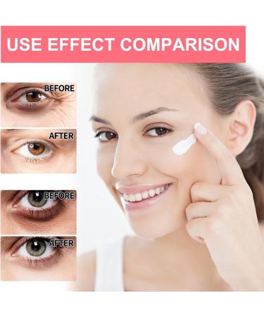 KOAHDE Retinol Eye Stick for Dark Circles Retinol Eye Anti Wrinkles Cream Eye Smoothens Wrinkles Stick Reduces Fine Lines and Dark Circles Anti Wrinkle Eye Cream for Puffy Eyes Under Eye Cream 1PC - Buy Online on GoSupps.com