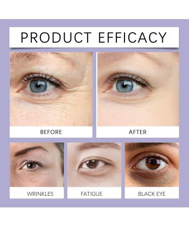  homomdy Retinol eye cream anti-aging for dark circles and puffiness moisturizing eye cream with collagen reduces fine lines and smooths wrinkles fragrance-free brightens and hydrates the skin - Buy Online on GoSupps.com