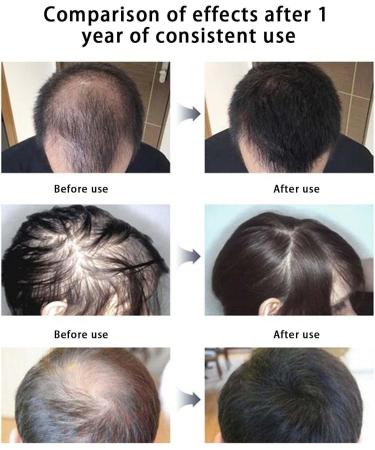  Yajimsa Multiflorum Nutrient Hair Essence - Hair Oil after shampoo with blend of natural vegetable oils for dry dull and damaged hair. Yajimsa - Buy Online on GoSupps.com