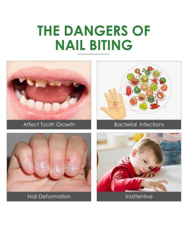 Feulover Nail-Biting & Thumb-Sucking Treatment for Kids & Adults - Bitter Taste Nail Care Solution with Safe Natural Plant Extract - 0.35 Fl Oz - Buy Online on GoSupps.com