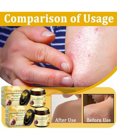 AYVROUP Cr me Raffermissante aux Principes Actifs d'Abeille pour le Soin des Jambes - 60g (2 Pi ces) - Buy Online on GoSupps.com