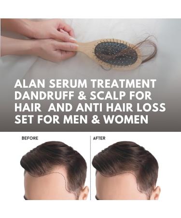 ABERA Alan Silver Serum Botanical Hydration for Sensitive Dry or Flaky Skin Plant-Based Face & Body Moisturizer with Black Ginger Neem Leaf & Cedar Oil 25ml 1 Box - Buy Online on GoSupps.com