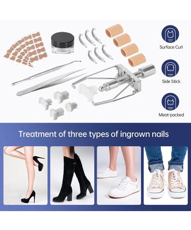 Ingrown Toenail Treatment Kit with 12 Podiatry Braces | Corrector Tool & 50pcs Patch | 10 Strips | White - Buy Online on GoSupps.com