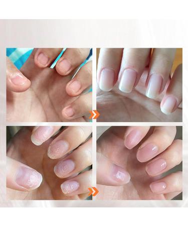 Cuticle Remover Nail Hardener and Cuticle Remover for Pedicure - Liquid Nail Oil Cuticle Softener 20ml Cuticle Repair Nail Strengthener for Damaged Nails Heal Cracked Nails Qiyifang - Buy Online on GoSupps.com