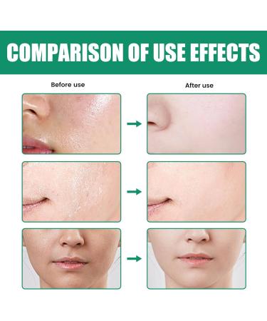 Pure Botanical Foaming Cleanser - Natural Tea Tree Extracts Centella Asiatica Extracts Soothing & Moisturising Exfoliator to Remove Pores & Blackheads (100ml) (1 piece) - Buy Online on GoSupps.com