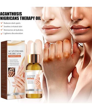 Black Spine Skin Repair Oil Moisturizes and Repairs Axillary Joints Arms Black Radiance Whitening Moisturizing and Beautifying Essential Oil (1 piece) - Buy Online on GoSupps.com
