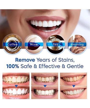 Buy Tailede & Neslemy Gum Therapy Gel - Effective Gums Protection & Teeth Whitening Pen (2 Pack) | International Shipping - Buy Online on GoSupps.com