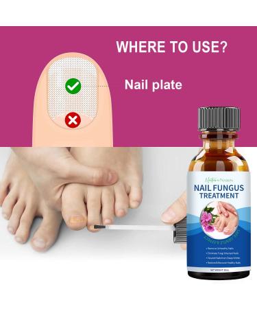 Extra Strength Toenail Fungus Treatment - Nail Repair Solution for Discolored Nails - Renew Damaged Toenails - Fingernail & Toenail Fungus Treatment - Buy Online on GoSupps.com