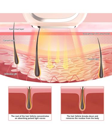 IPL Hair Removal Device - 999 900 Pain-Free Flashes for Body Face & Bikini - Freeze Point Technology - Unisex - Buy Online on GoSupps.com