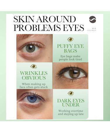 Aloe Vera Eye Patches for Dark Circles - Collagen under Eye Mask - Eye Bags Remover - Lasting Moisturizing - Relieves Dry Eyes - Eye Care Products - Buy Online on GoSupps.com