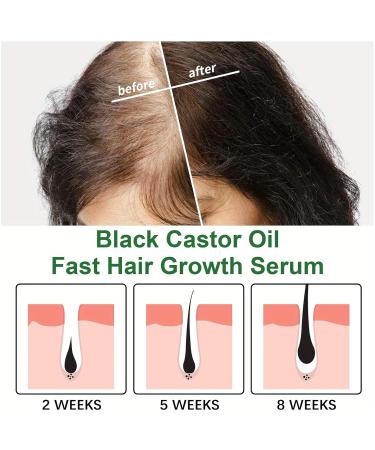 2 PCS Organic Black Castor Oil - Cold Pressed Unrefined Massage Oil for Hair Skin & Eyelashes | Moisturizing in Glass Bottle - Buy Online on GoSupps.com