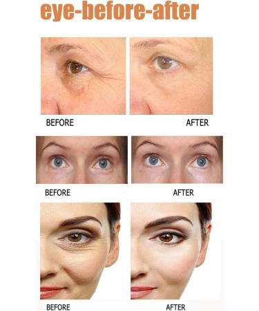 2 Minutes Instantly Eye Bag Removal Long Lasting Effect Puffiness Wrinkles Fine Lines Remove For Eyes For The - Buy Online on GoSupps.com