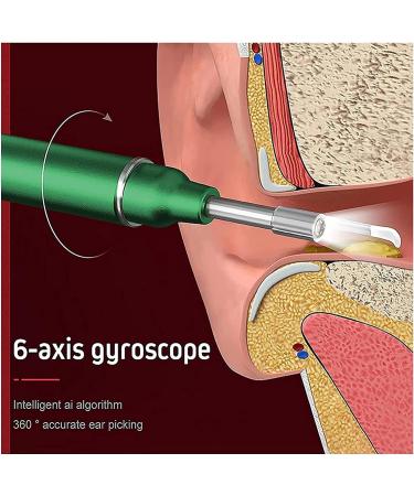 KouRy Ear Wax Removal Tool Ear Cleaner Earwax Removal Camera 1080P FHD Endoscope Wireless Ear Wax Remover Otoscope with LED Light Safe Ear Wax Removal Kit for Adults Kids &Pets (Green) - Buy Online on GoSupps.com