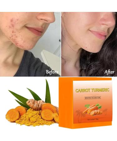 Organic Turmeric Soap Bar | Handmade Face & Body Soap for Acne & Dark Spots | Cleansing Turmeric Soaps for Dull Skin - International Shipping - Buy Online on GoSupps.com