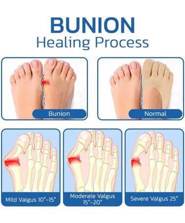 Projoint Antibunions Health Socks - Bunion Relief & Strongjoints Support (5PCS Black) - Buy Online on GoSupps.com