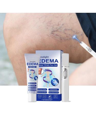 FRTG Varicose veins cream varicose veins with blue light laser treatment pen 1 treatment with blue light laser 1 Varicose Vein Soothing Cream treatment of varicose veins on the legs - Buy Online on GoSupps.com