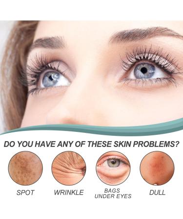 Shantou Yingji 2 pieces pigment spot remover cream against pigment spots face cream antipigmentation spots face with niacinamide and retinol reduces hyperpigmentation age spots and sun spots - Buy Online on GoSupps.com