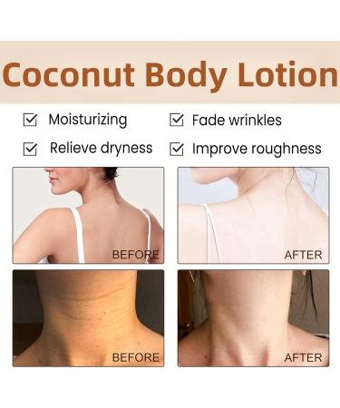 200g Large-Capacity Coconut Body Lotion Skin Care Body Moisturisers Butter Moisturiser Coconut Cream for Skin Coconut Body Cream Coconut Butter for Skin Hydrating Cream Body Cream Body Moisturizer - Buy Online on GoSupps.com