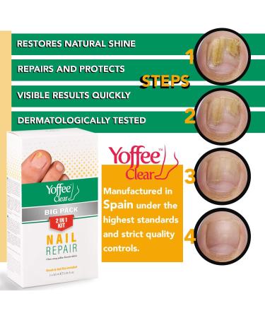 Yoffee Clear Nail Care Kit - 2 x 60ml Bottles, Fungal Nail Treatment with Argan Oil & Tea Tree Oil - Antibacterial, Antiseptic, Antifungal - Made in Spain - Buy Online on GoSupps.com