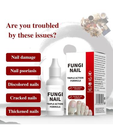 Toenail Fungus Treatment Overnight Long Lasting Nail Treatment for Athletes Foot Thick Broken Discolored and Damaged Nails 15 Ml05 Oz 1 pcs - Buy Online on GoSupps.com