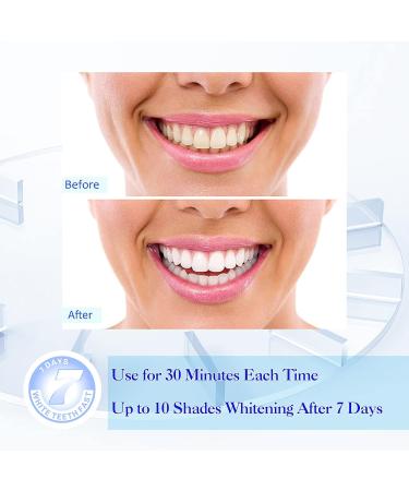 Sensitivity-Friendly Teeth Whitening Strips - Brighten Your Smile with Ease - Buy Online on GoSupps.com
