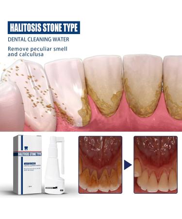 Effective Tartar & Yellowed Teeth Mouth Spray - Long-Lasting Freshness | International Shipping - Buy Online on GoSupps.com