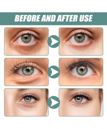 1 Pcs Jasmine Eye Cream Jasmine Ointment For Dark Circles Jasmine Active Ointment Jasmine Eye Cream Reduces Dark Circles Fine Lines Bags And Wrinkles Under The Eyes - Buy Online on GoSupps.com