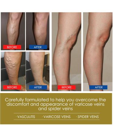 3 Pack Lukmlca Bienengift Fußbad & Lymphdrainage Ointment - Revitalize Your Feet & Boost Wellness Internationally - Buy Online on GoSupps.com