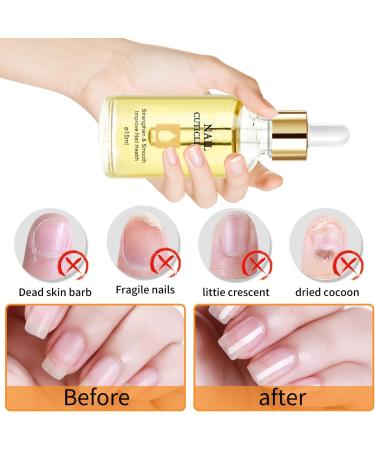 Nail Cuticle Oil for Nail Care - Cuticle Oil with Organic Vitamin E & B Cuticle Oil for Nails Nail Oil Soothe Moisturize with Dropper Design to Prevent Nail Cracking and Dry Orange - Buy Online on GoSupps.com