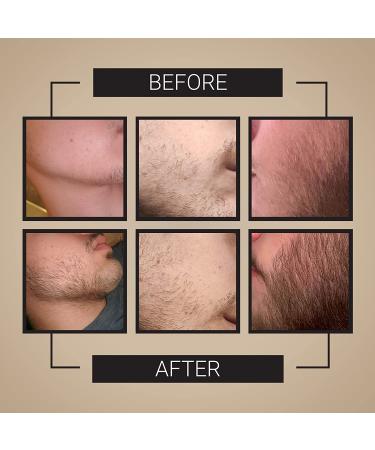 Crafted Beard Growth Kit - 3x Oil, Roller, Vitamins - Thicker Fuller Beard - 3 Month Supply - Buy Online on GoSupps.com