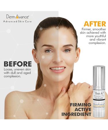 Tret A Anti-Aging Face Cream - Retinaldehyde 0.15% Lotion for Youthful Skin - 15ml Advanced Radiance Face Lotion for Women - Buy Online on GoSupps.com