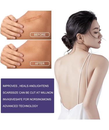 Scar Gel Tape: Reusable Scar Removal Strips | Promotes Moisture Retention | Safe for C-Section Scars - Buy Online on GoSupps.com