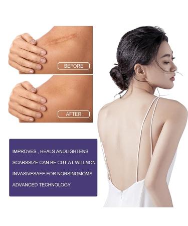 Invisible Silicone Scar Sheets | Promotes Circulation | Surgical & Caesarean Scar Removal Strips - Buy Online on GoSupps.com
