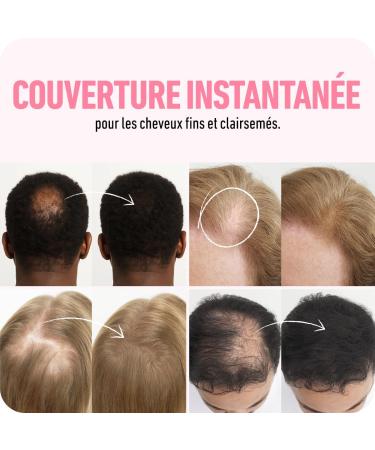 BOLDIFY Fibres Capillaires Naturelles 12g Poudre Densifiante Masque la Perte de Cheveux en 15s Pour Hommes et Femmes (Brun Cendr ) 12 g (Lot de 1) Brun Cendr  - Buy Online on GoSupps.com