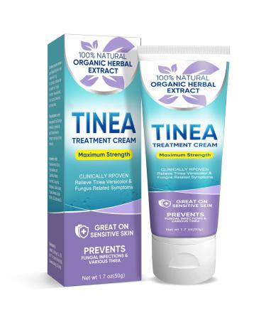 Tinea Versicolor Treatment Natural Skin Cream for All Skin Types