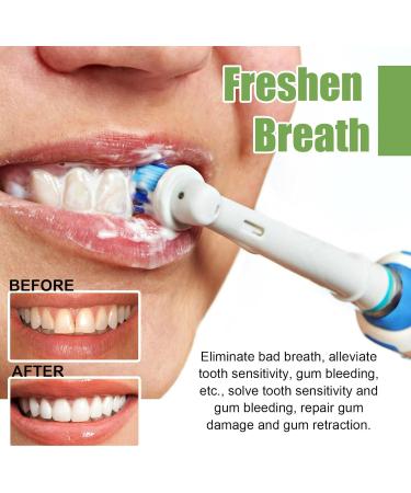 Buy Tlopa Ampoule Toothpaste Serum - Best Plaque Control for Healthy Teeth | International Shipping Available - Buy Online on GoSupps.com