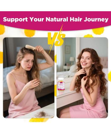 Aromlife Postpartum Hair Loss Gummies for Women Stronger Hair Postpartum Hair Gummies with Biotin Folate Zine Vitamin E B6 & B12 60 Count Vegan Breastfeeding-Friendly Postnatal Vitamins Gummy - Buy Online on GoSupps.com