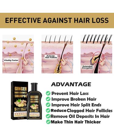 Ginger Hair Growth Set - Anti Hair Loss Shampoo & Serum for Thickening, Nourishing Scalp, Natural Baldness Treatment - Men & Women - 2 Pack (1A+1B) - Buy Online on GoSupps.com