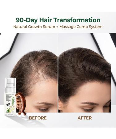 Spray Naturel pour la Croissance des Cheveux avec Huile de Romarin S rum Capillaire Anti-Chute et Densifiant 60 ml + Peigne de Massage en Bois pour Soin du Cuir Chevelu Hommes & Femmes - Buy Online on GoSupps.com