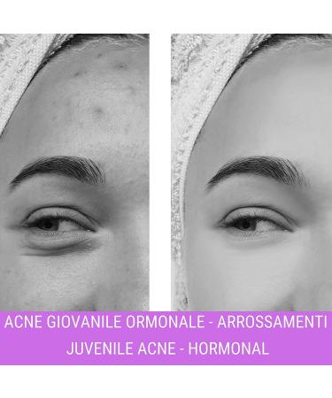 Nuvo' Face Cream H24 with 60% SNAIL SLIME Hyaluronic Acid Collagen Marine Aloe Vitamin C - E Kiwi Cells Moisturizing Impure Skin Acne Anti Wrinkle Face Neck D collet 50ml - Buy Online on GoSupps.com