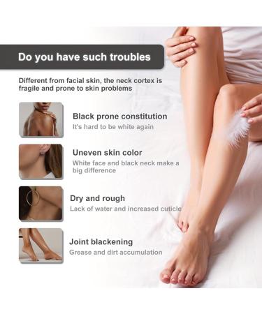 WOBBLO Intimate Lightening Cream Natural Lightening Cream for Intimate Areas Skin Whitening Cream for Intimate Areas Underarms Knees Elbows - Buy Online on GoSupps.com