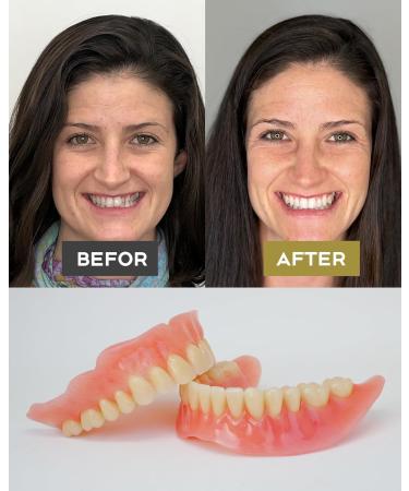 DIY Denture Fake Teeth - Temporary Top & Bottom Teeth for All Situations | Easy & Convenient - Buy Online on GoSupps.com